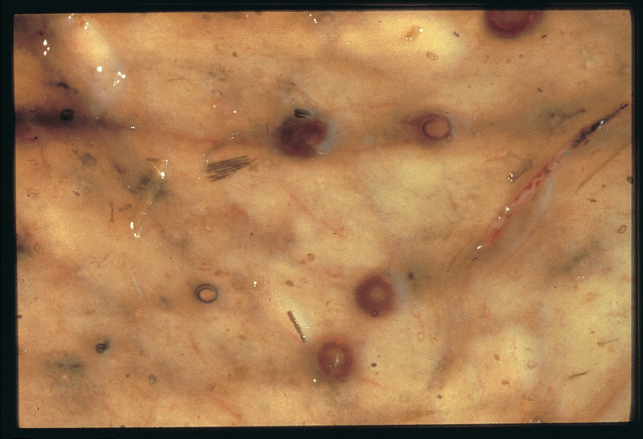 Zoetis warns of risk of cyathostominosis The Gaitposy